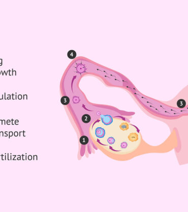 Assisted Reproduction Technique