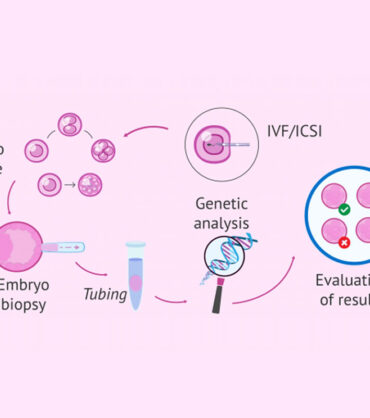 Preimplantation Genetic Diagnosis